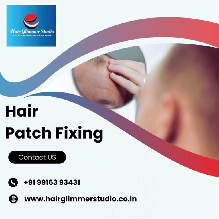 Hair Patch Fixing in Bangalore 768x768