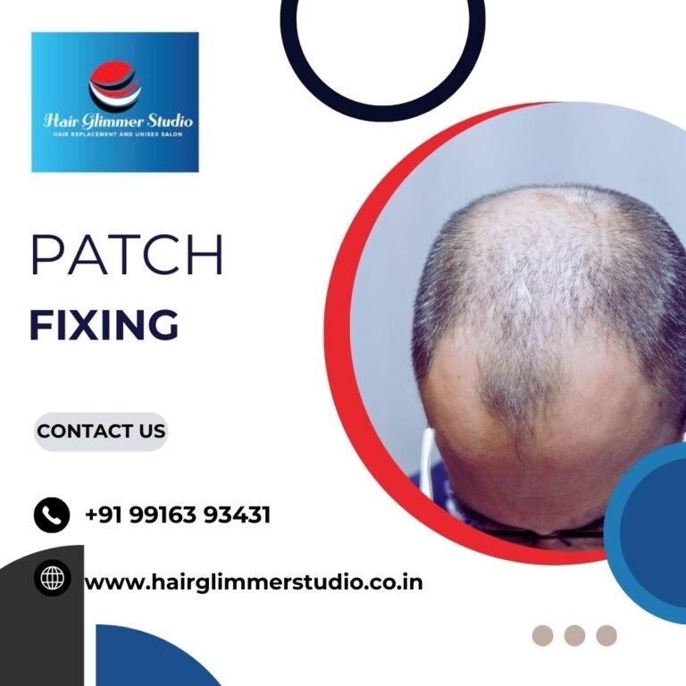 Patch fixing in Bangalore 768x768